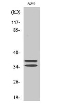 LAT antibody