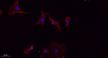 LATS1/2 antibody