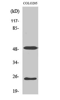 LRAT antibody