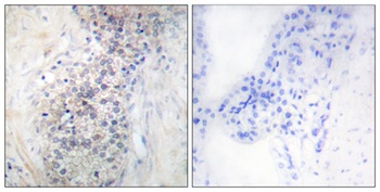 LRAT rabbit pAb Antibody