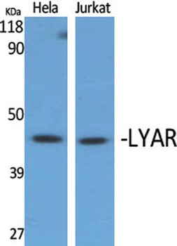 LYAR antibody