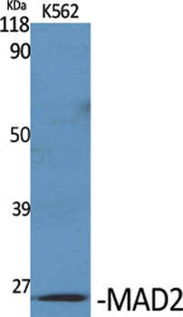 MAD2 antibody