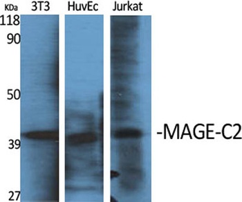 MAGE-C2 antibody