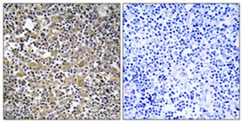 MAST205 rabbit pAb Antibody