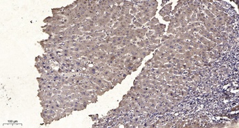 MEK-4 rabbit pAb Antibody