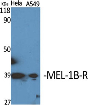 MEL-1B-R rabbit pAb