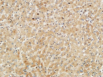 Met rabbit pAb Antibody