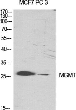 MGMT antibody