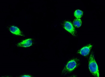 MIF rabbit pAb Antibody
