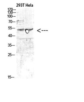 MITF antibody