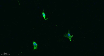 MMP-13 antibody