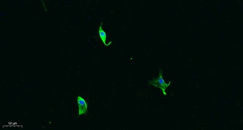 MMP-13 rabbit pAb