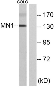 MN1 rabbit pAb Antibody