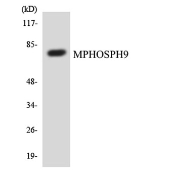 MPP9 rabbit pAb Antibody
