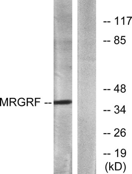 MRGF rabbit pAb Antibody