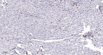 MRGF rabbit pAb Antibody