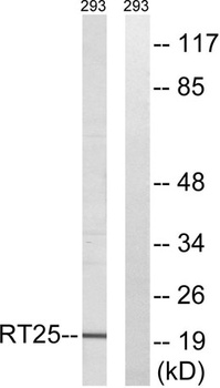 MRP-S25 rabbit pAb Antibody