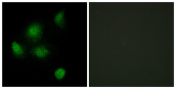 Sin3B rabbit pAb Antibody