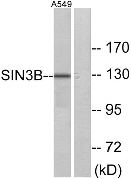 Sin3B rabbit pAb Antibody