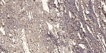 MTHFR rabbit pAb Antibody