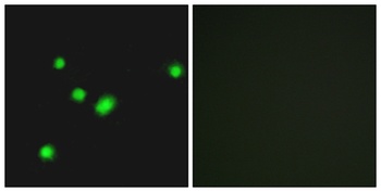 MYH rabbit pAb Antibody