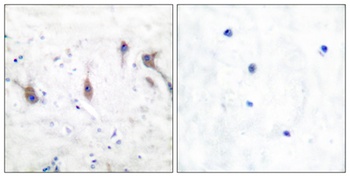 Myp rabbit pAb Antibody