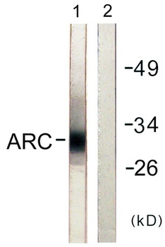 Myp rabbit pAb Antibody