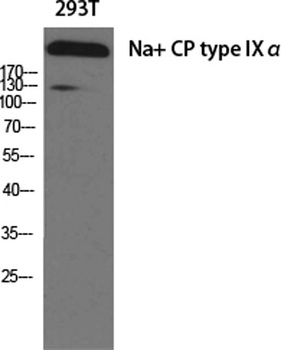 Na+ CP type IX alpha antibody