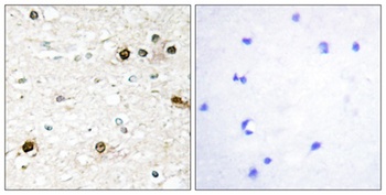 NAB2 rabbit pAb Antibody