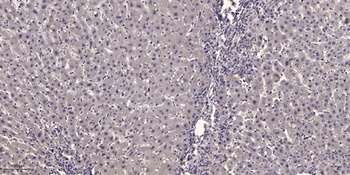 NBPF7 rabbit pAb Antibody