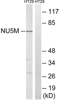 ND5 rabbit pAb Antibody