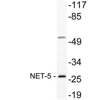 NET-5 rabbit pAb Antibody