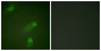 NFκB-p105 rabbit pAb Antibody