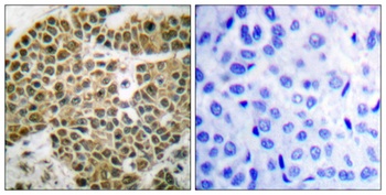 NFκB-p105 rabbit pAb Antibody