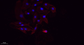 NGF antibody