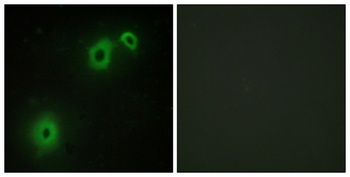 NGFR p75 rabbit pAb Antibody