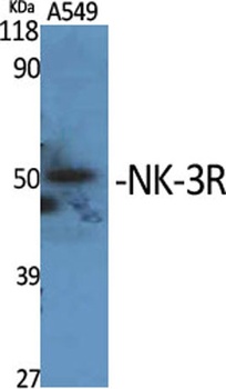 Neurokinin B receptor antibody
