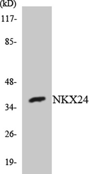 Nkx-2.4 rabbit pAb Antibody