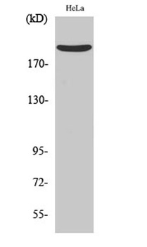 Nogo A antibody