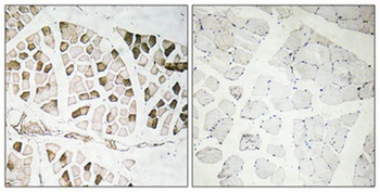Nogo A rabbit pAb Antibody