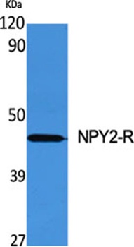 NPY2-R antibody