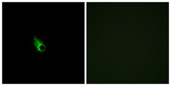 Olfactory receptor 52E1 rabbit pAb Antibody