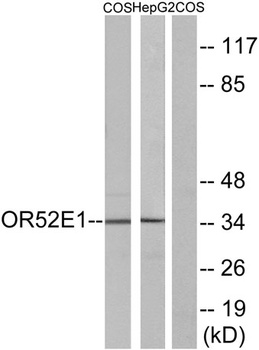 Olfactory receptor 52E1 rabbit pAb Antibody