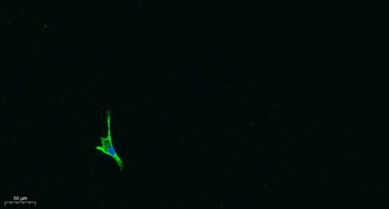 OPG antibody