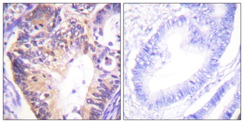 PAKα rabbit pAb Antibody