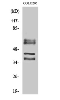 Periphilin 1 antibody