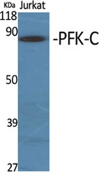 PFK-C antibody