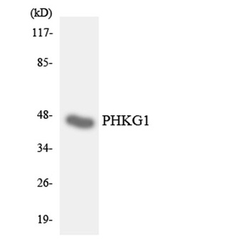PHKG1 antibody
