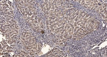 PHKG1 rabbit pAb Antibody