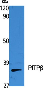 PITPbeta antibody